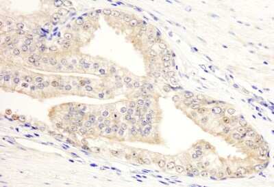 Immunohistochemistry: KANK2 Antibody [NB100-68217]