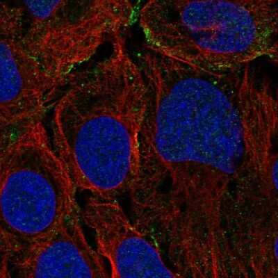 Immunocytochemistry/ Immunofluorescence: KANK3 Antibody [NBP2-14138]