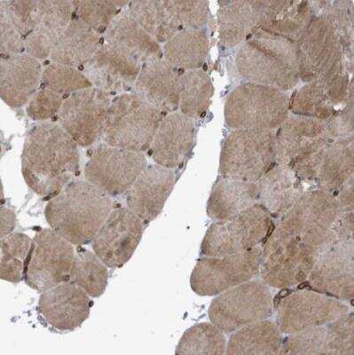 Immunohistochemistry-Paraffin: KANK3 Antibody [NBP2-14138]
