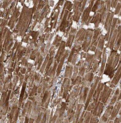 Immunohistochemistry-Paraffin: KANK3 Antibody [NBP2-14138]