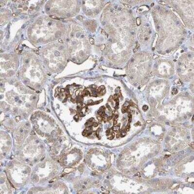 Immunohistochemistry-Paraffin: KANK3 Antibody [NBP2-14138]