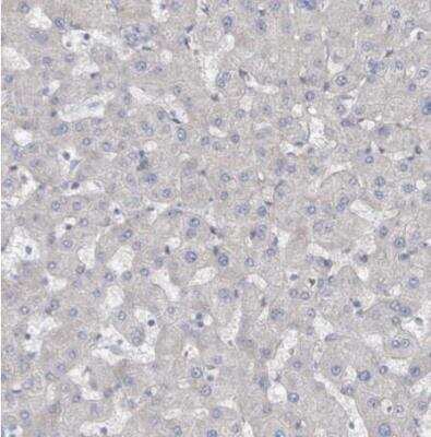 Immunohistochemistry-Paraffin: KANK3 Antibody [NBP2-14138]