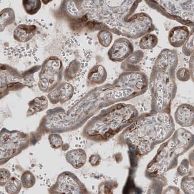 Immunohistochemistry-Paraffin: KANK4 Antibody [NBP1-89079]