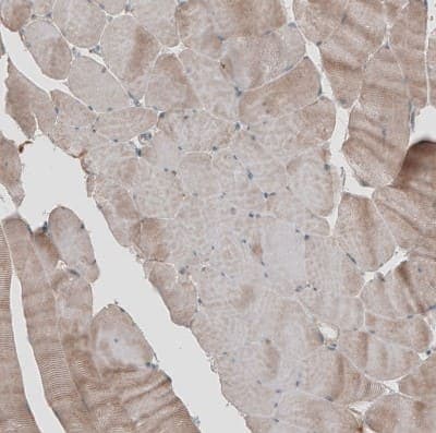 Immunohistochemistry-Paraffin: KANK4 Antibody [NBP1-89079]
