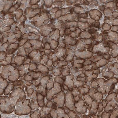 Immunohistochemistry-Paraffin: KANK4 Antibody [NBP1-89079]