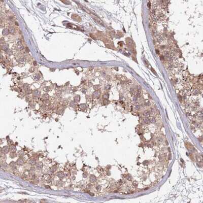 Immunohistochemistry-Paraffin: KANSL1L Antibody [NBP2-14139]