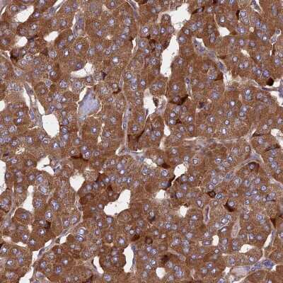 Immunohistochemistry-Paraffin: KANSL1L Antibody [NBP2-14796]