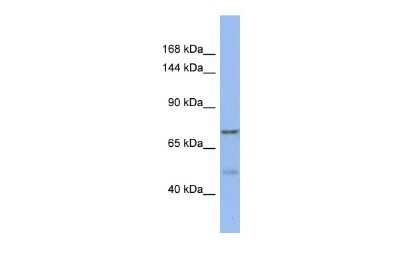Western Blot: KANSL1L Antibody [NBP2-85129]