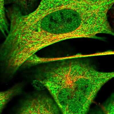 Immunocytochemistry/ Immunofluorescence: KANSL2 Antibody [NBP2-32637]