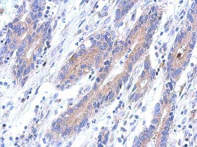 Immunohistochemistry-Paraffin: KANSL2 Antibody [NBP2-15633]