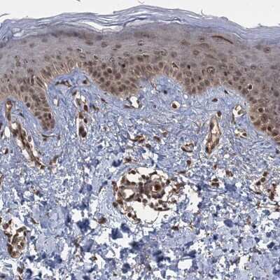 Immunohistochemistry-Paraffin: KANSL2 Antibody [NBP2-32637]