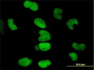 Immunocytochemistry/ Immunofluorescence: KAP1 Antibody (4E6) [H00010155-M01]