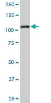 Western Blot: KAP1 Antibody (4E6) [H00010155-M01]