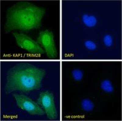 Immunocytochemistry/ Immunofluorescence: KAP1 Antibody [NB100-1161]