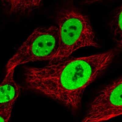 Immunocytochemistry/ Immunofluorescence: KAP1 Antibody [NBP2-39014]