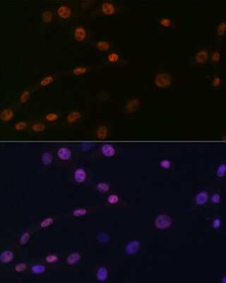Immunocytochemistry/ Immunofluorescence: KAT1 Antibody (7U2O3) [NBP3-16412]