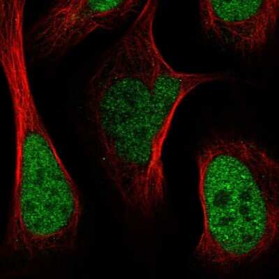 Immunocytochemistry/ Immunofluorescence: KAT1 Antibody [NBP1-87835]