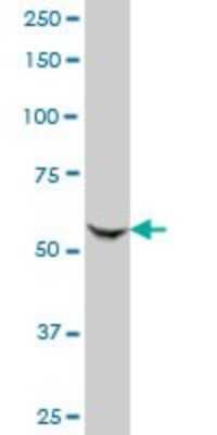 Western Blot: KAT2A/GCN5 Antibody (3F8) [H00002648-M06]