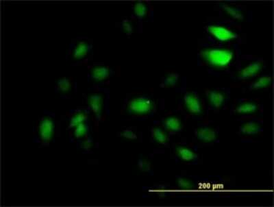 Immunocytochemistry/ Immunofluorescence: KAT2A/GCN5 Antibody (4D3) [H00002648-M01]