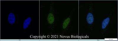 Immunocytochemistry/ Immunofluorescence: KAT3B/p300 Antibody (RW128) - BSA Free [NB100-507]