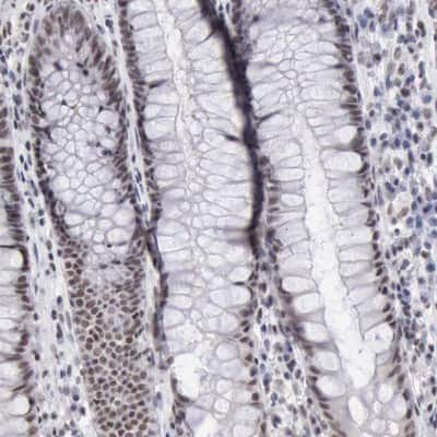 Immunohistochemistry-Paraffin: KAT4/TBP Associated Factor 1 Antibody [NBP1-90036]