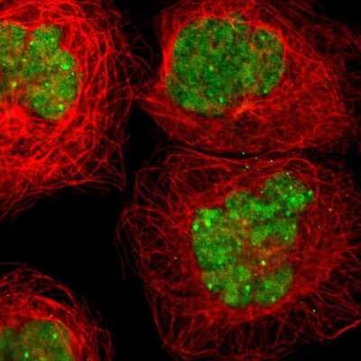 Immunocytochemistry/ Immunofluorescence: KAT6B-MORF Antibody [NBP1-92036]
