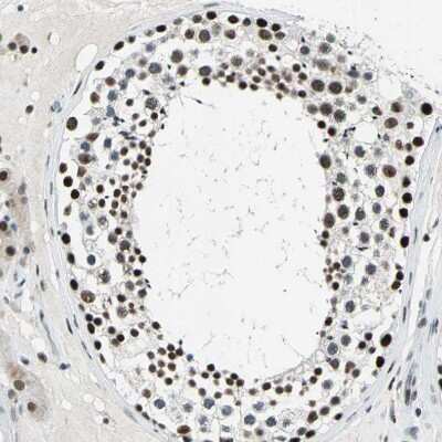 Immunohistochemistry-Paraffin: KAT6B-MORF Antibody [NBP1-92036]