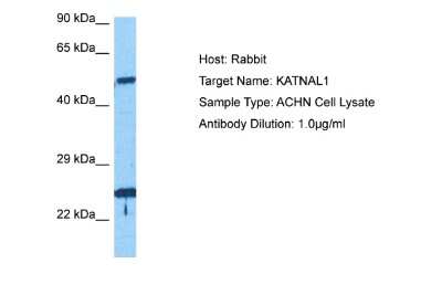 Western Blot: KATNAL1 Antibody [NBP2-86689]