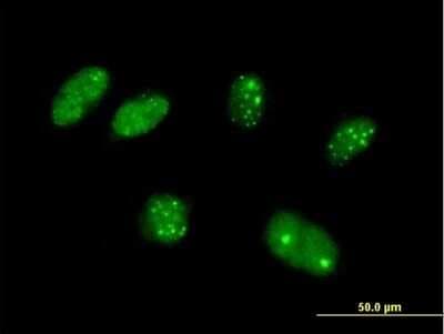 Immunocytochemistry/ Immunofluorescence: KATNAL2 Antibody [H00083473-B01P]