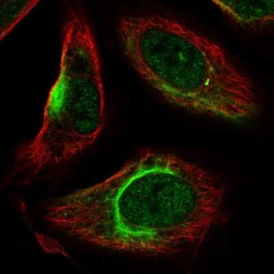 Immunocytochemistry/ Immunofluorescence: KATNAL2 Antibody [NBP2-30452]