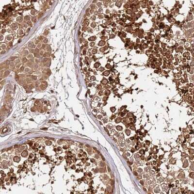 Immunohistochemistry-Paraffin: KATNAL2 Antibody [NBP2-30452]