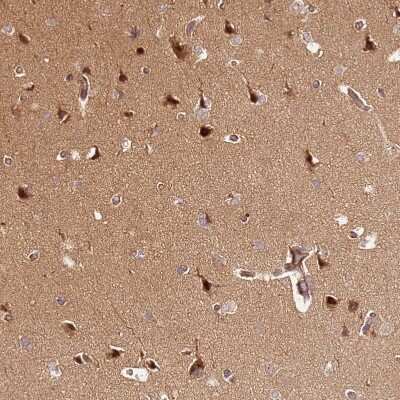 Immunohistochemistry-Paraffin: KATNAL2 Antibody [NBP2-30452]