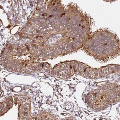 Immunohistochemistry-Paraffin: KATNAL2 Antibody [NBP2-30452]
