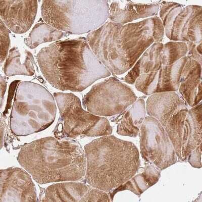 Immunohistochemistry-Paraffin: KATNAL2 Antibody [NBP2-30452]