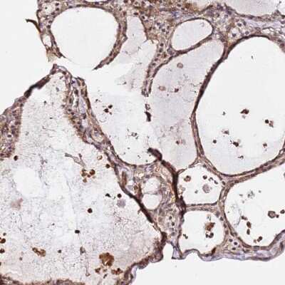Immunohistochemistry-Paraffin: KATNAL2 Antibody [NBP2-30452]