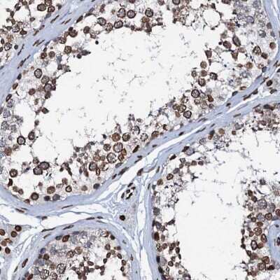 Immunohistochemistry-Paraffin: KATNAL2 Antibody [NBP2-30844]