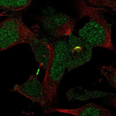 Immunocytochemistry/ Immunofluorescence: KATNBL1 Antibody [NBP2-31859]