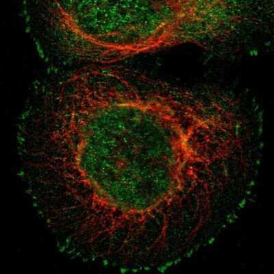 Immunocytochemistry/ Immunofluorescence: KBTBD10 Antibody [NBP1-80786]