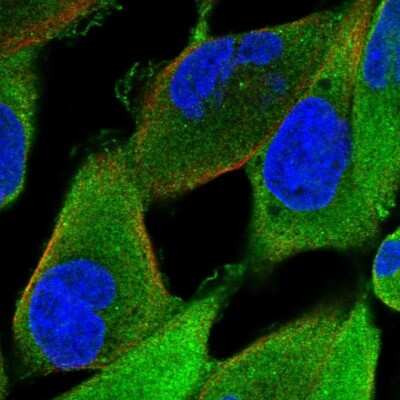 Immunocytochemistry/ Immunofluorescence: KBTBD10 Antibody [NBP1-80787]