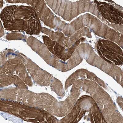 Immunohistochemistry-Paraffin: KBTBD10 Antibody [NBP1-80788]