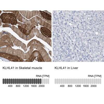 Immunohistochemistry-Paraffin: KBTBD10 Antibody [NBP1-80788]