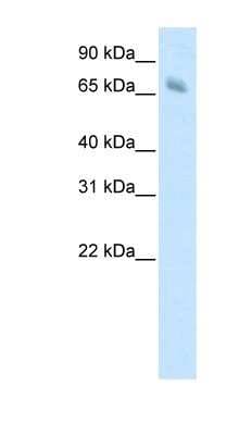 Western Blot: KBTBD10 Antibody [NBP1-80310]