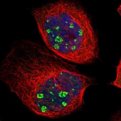 Immunocytochemistry/ Immunofluorescence: KBTBD2 Antibody [NBP1-88588]