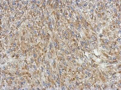 Immunohistochemistry-Paraffin: KBTBD3 Antibody [NBP2-17022]
