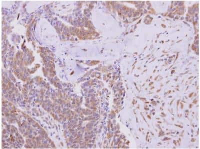 Immunohistochemistry-Paraffin: KBTBD3 Antibody [NBP2-17023]