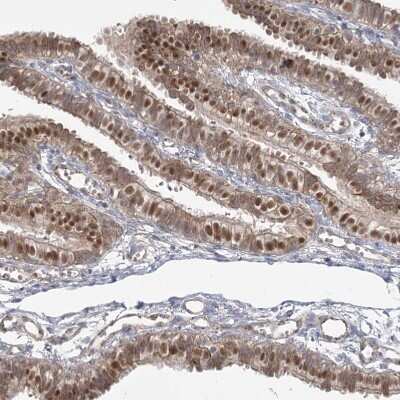 Immunohistochemistry-Paraffin: KBTBD4 Antibody [NBP1-88587]