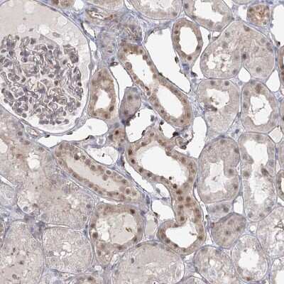 Immunohistochemistry-Paraffin: KBTBD4 Antibody [NBP1-88587]