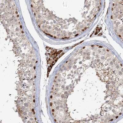 Immunohistochemistry-Paraffin: KBTBD4 Antibody [NBP1-88587]