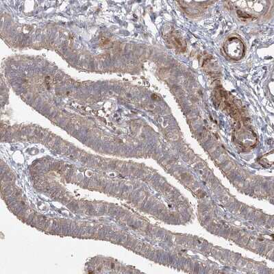 Immunohistochemistry-Paraffin: KBTBD4 Antibody [NBP2-38363]