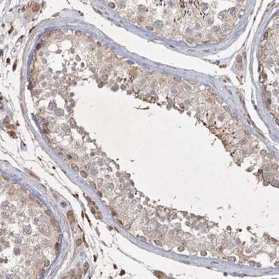 Immunohistochemistry-Paraffin: KBTBD4 Antibody [NBP2-38363]